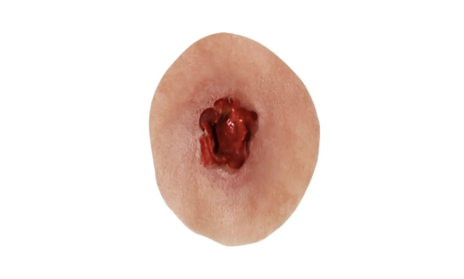 Gunshot Exit Wound Small