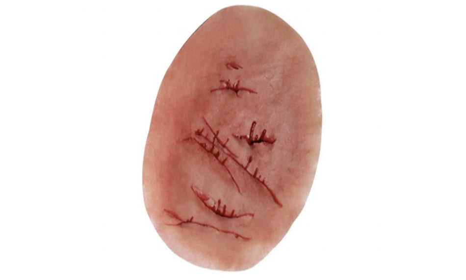 Multiple Incised Wounds